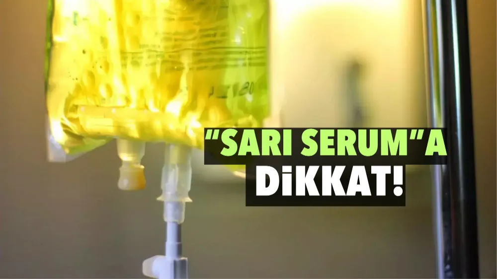 “SARI SERUM”A DİKKAT!