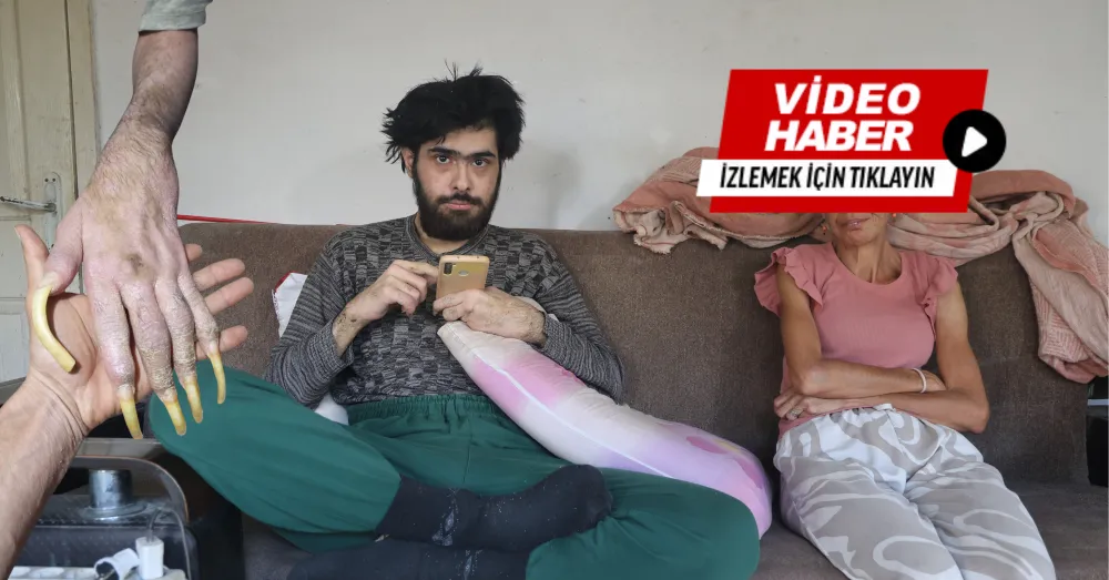 3 YILDIR BANYO YAPMIYOR, TIRNAKLARINI KESMİYOR
