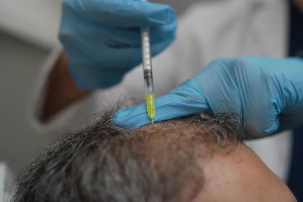 DÖKÜLEN SAÇLAR VÜCUDUN BİR ALARMI OLABİLİR