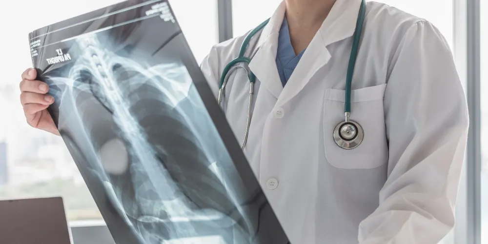 AKCİĞER KANSERİNDE ERKEN TEŞHİS TEDAVİDE BAŞARIYI ARTIRIYOR