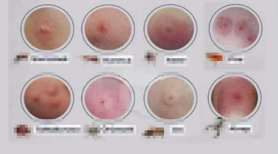 BU ISIRIK KİME AİT? 