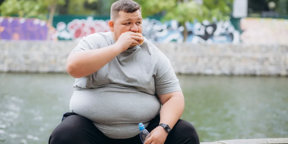 OBEZİTE ÖMRÜ 10 YIL KISALTIYOR